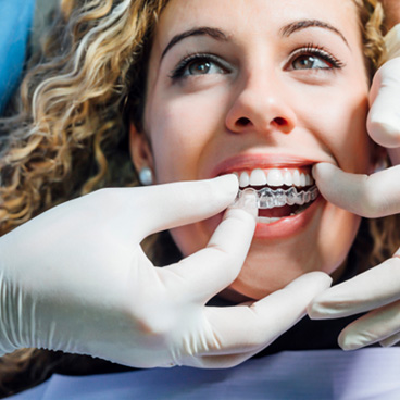 Dentist putting clear aligner on patient