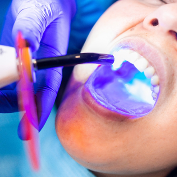 Person receiving direct bonding 