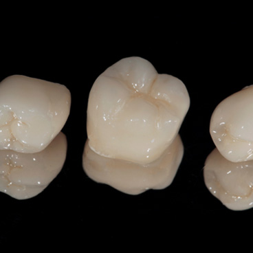 Three dental crowns sitting on reflective surface