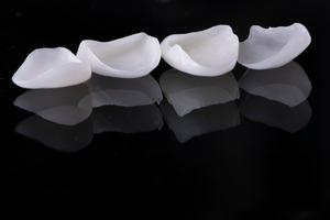 Four veneers sitting on black reflective surface